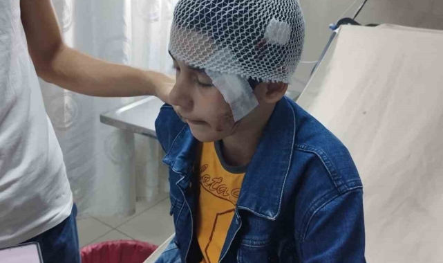 Salıncakta eğlenen çocuk bir anda kanlar içinde kaldı
