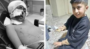 11 yaşındaki çocuğa başıboş köpekler saldırdı: Her yeri paramparça olmuş