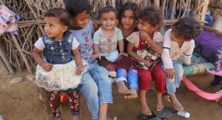 UNICEF: Yemen'de 5 yaş altı her 2 çocuktan 1'i akut yetersiz besleniyor