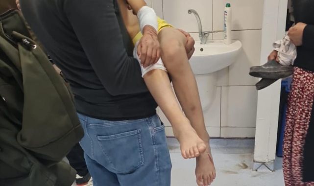 Başıboş köpekler 9 yaşındaki çocuğa saldırdı