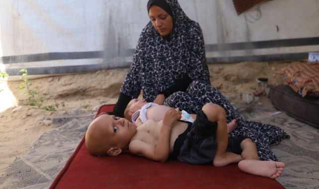 Haaretz yazarı, İsraillilerin Gazze'de işlenen insanlık suçlarını görmezden gelmesini eleştirdi