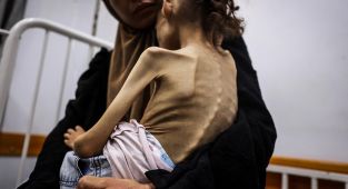 Gazzede 9 yaşındaki Meryem, 25 kilodan 10 kiloya düştü