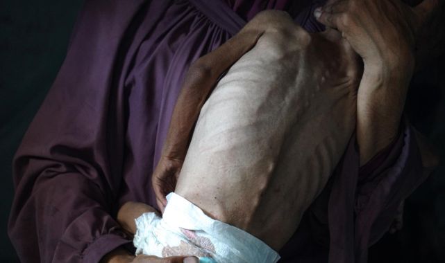 Gazze'de son 24 saatte 5 Filistinli daha açlıktan hayatını kaybetti