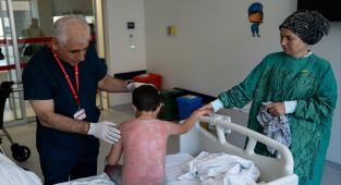 Güneşte 4 saat kalan çocuk, ikinci derece yanık oldu