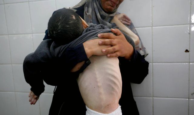 Soykırımcı İsrail'in kıtlığı dayattığı Gazzede 2 Filistinli daha açlıktan hayatını kaybetti