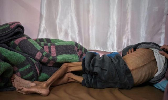 Gazze'de son 24 saatte 3'ü çocuk 9 kişi daha açlıktan hayatını kaybetti