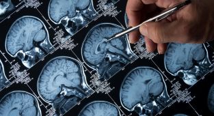 Alzheimer ve kanser, yakında duyamadığımız seslerle tedavi edilebilir
