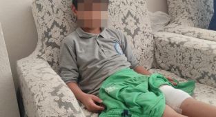 Okul yolunda başıboş köpeğin saldırısına uğradı